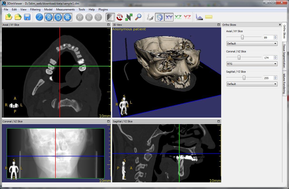 3DimViewer - Created by PostDICOM